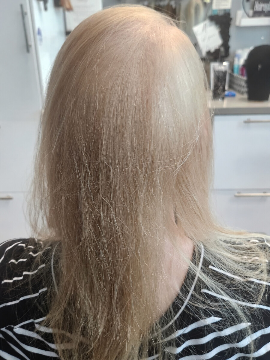 Fine ash-blonde hair, sparse at the crown, before