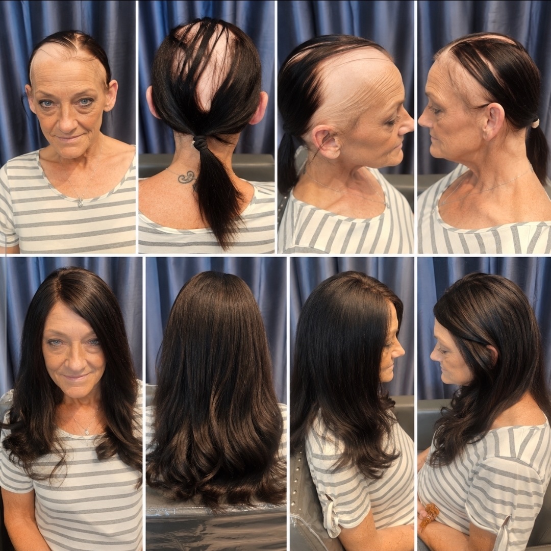 One client in eight views: thinning at the crown before, then long, dark, layered hair past her shoulders in her custom wig